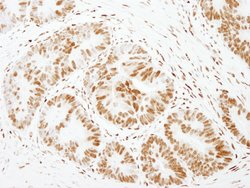 FOXK1 Polyclonal Antibody, Bethyl Laboratories:Antibodies:Primary Antibodies