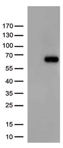 FOXN2 Monoclonal Antibody (OTI7D12), TrueMAB , OriGene:Antibodies:Primary