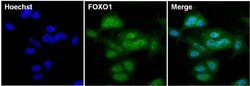 Invitrogen FOXO1 Monoclonal Antibody (3B6) 100 &mu;g; Unconjugated:Antibodies,