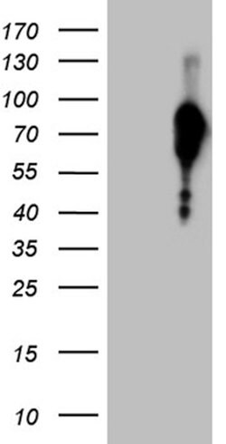 FOXO1 Mouse anti-Human, Clone: OTI2H4, lyophilized, TrueMAB 100 &mu;g;
