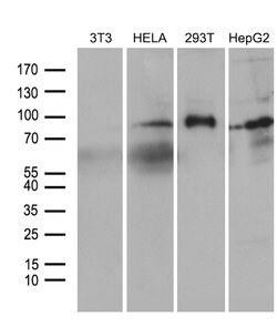 FOXO1 Mouse anti-Human, Clone: OTI2H4, lyophilized, TrueMAB 100 &mu;g;