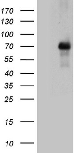 FOXO1 Monoclonal Antibody (OTI8F12), TrueMAB , OriGene 100 &mu;L | Buy Online | OriGene | Fisher Scientific