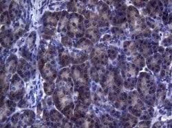 FOXO3 Monoclonal Antibody (OTI5F11), TrueMAB , OriGene 100 &mu;L; Unconjugated:Antibodies,