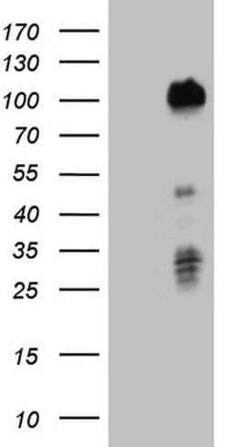 FOXO3 Monoclonal Antibody (OTI5F11), TrueMAB , OriGene 100 &mu;L; Unconjugated:Antibodies,