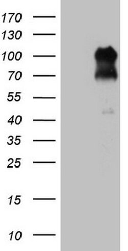 FOXO3 Mouse anti-Human, Clone: OTI3E6, lyophilized, TrueMAB 100 &mu;g | Buy Online | Origene Technologies | Fisher Scientific