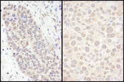 FOXO3a Rabbit anti-Human, Mouse, Polyclonal, Bethyl Laboratories 100 &mu;L;