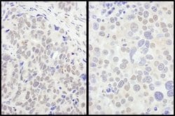 FOXO3a Rabbit anti-Human, Mouse, Polyclonal, Bethyl Laboratories 100 &mu;L;