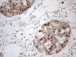 FOXO4 Mouse anti-Human, Clone: OTI8A8, lyophilized, TrueMAB 100 &mu;g;
