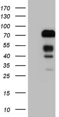 FOXO4 Mouse anti-Human, Clone: OTI1A4, lyophilized, TrueMAB 100 &mu;g;