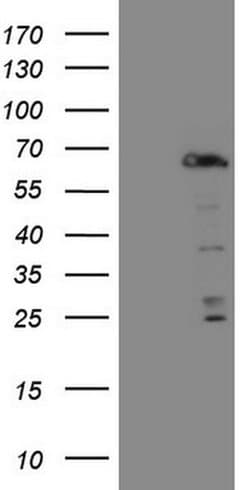 FOXO4 Monoclonal Antibody (OTI10F12), TrueMAB , OriGene:Antibodies:Primary