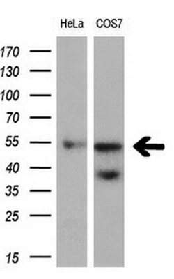 FOXO4 Monoclonal Antibody (OTI5A5), TrueMAB , OriGene 100 &mu;L; Unconjugated:Antibodies,