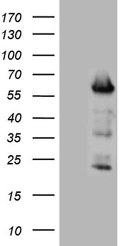 FOXO4 Monoclonal Antibody (OTI8F1), TrueMAB , OriGene 100 &mu;L; Unconjugated:Antibodies,