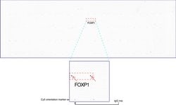 FOXP1 Mouse anti-Human, Mouse, Rat, Clone: UMAB89, liquid, UltraMAB 100