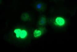 FOXP1 Monoclonal Antibody (OTI4D2), TrueMAB , OriGene 100 &mu;L; Unconjugated:Antibodies,