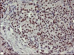FOXP1 Monoclonal Antibody (OTI4D2), TrueMAB , OriGene 100 &mu;L; Unconjugated:Antibodies,