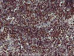 FOXP1 Monoclonal Antibody (OTI4D2), TrueMAB , OriGene 100 &mu;L; Unconjugated:Antibodies,
