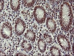 FOXP1 Monoclonal Antibody (OTI4D2), TrueMAB , OriGene 100 &mu;L; Unconjugated:Antibodies,