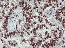 FOXP1 Monoclonal Antibody (OTI1G7), TrueMAB , OriGene 30 &mu;L; Unconjugated:Anticuerpos