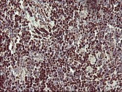 FOXP1 Monoclonal Antibody (OTI1G7), TrueMAB , OriGene 30 &mu;L; Unconjugated:Anticuerpos