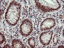 FOXP1 Monoclonal Antibody (OTI1G7), TrueMAB , OriGene 30 &mu;L; Unconjugated:Anticuerpos