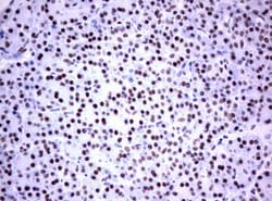 FOXP1 Mouse anti-Human, Clone: OTI3G3, lyophilized, TrueMAB 100 &mu;g;