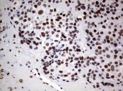 FOXP1 Mouse anti-Human, Clone: OTI3G3, lyophilized, TrueMAB 100 &mu;g;