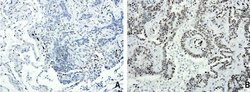 FOXP1 Mouse anti-Human, Mouse, Rat, Clone: UMAB89, liquid, UltraMAB 100