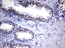 FOXP1 Mouse anti-Human, Mouse, Rat, Clone: UMAB89, liquid, UltraMAB 100