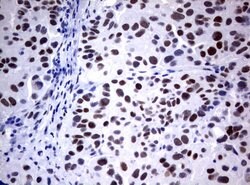 FOXP1 Mouse anti-Human, Mouse, Rat, Clone: UMAB89, liquid, UltraMAB 100