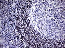 FOXP1 Mouse anti-Human, Mouse, Rat, Clone: UMAB89, liquid, UltraMAB 100