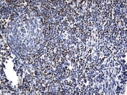 FOXP1 Mouse anti-Human, Clone: UMAB242, liquid, UltraMAB 100 &mu;L; Unconjugated:Antibodies,