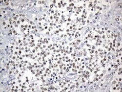 FOXP1 Mouse anti-Human, Clone: UMAB242, liquid, UltraMAB 100 &mu;L; Unconjugated:Antibodies,