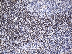FOXP1 Mouse anti-Human, Clone: UMAB242, liquid, UltraMAB 100 &mu;L; Unconjugated:Antibodies,