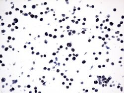 FOXP1 Mouse anti-Human, Clone: UMAB242, liquid, UltraMAB 100 &mu;L; Unconjugated:Antibodies,