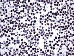 FOXP1 Mouse anti-Human, Clone: UMAB242, liquid, UltraMAB 100 &mu;L; Unconjugated:Antibodies,