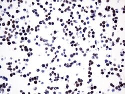 FOXP1 Mouse anti-Human, Clone: UMAB242, liquid, UltraMAB 100 &mu;L; Unconjugated:Antibodies,