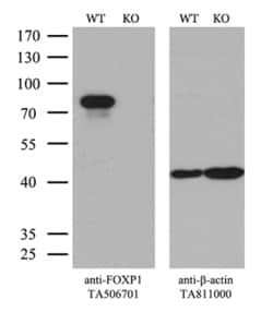 FOXP1 Monoclonal Antibody (OTI1G7), TrueMAB , OriGene 30 &mu;L; Unconjugated:Anticuerpos