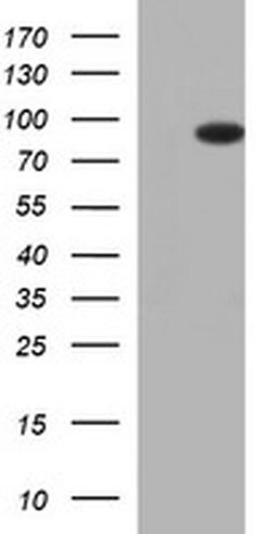 FOXP1 Monoclonal Antibody (OTI4D2), TrueMAB , OriGene 100 &mu;L; Unconjugated:Antibodies,