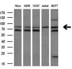 FOXP1 Monoclonal Antibody (OTI4D2), TrueMAB , OriGene 100 &mu;L; Unconjugated:Antibodies,