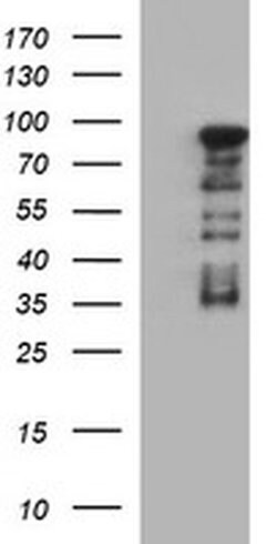 FOXP1 Monoclonal Antibody (OTI1G7), TrueMAB , OriGene 30 &mu;L; Unconjugated:Anticuerpos