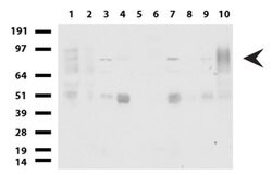 FOXP1 Mouse anti-Human, Mouse, Rat, Clone: UMAB89, liquid, UltraMAB 100