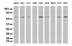 FOXP1 Mouse anti-Human, Mouse, Rat, Clone: UMAB89, liquid, UltraMAB 100