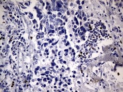FOXP3 Mouse anti-Human, Clone: OTI3D1, lyophilized, TrueMAB 100 &mu;g;