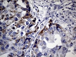 FOXP3 Mouse anti-Human, Clone: OTI3D1, lyophilized, TrueMAB 100 &mu;g;
