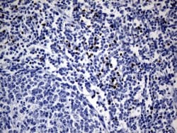 FOXP3 Monoclonal Antibody (OTI3D1), TrueMAB , OriGene 100 &mu;L; Unconjugated:Antibodies,