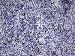 FOXP3 Mouse anti-Human, Clone: OTI3D1, lyophilized, TrueMAB 100 &mu;g;