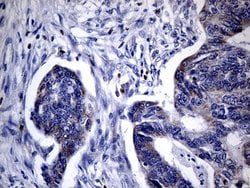 FOXP3 Mouse anti-Human, Clone: OTI3D1, lyophilized, TrueMAB 100 &mu;g;
