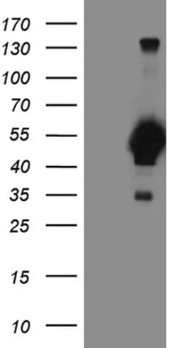 FOXP3 Mouse anti-Human, Clone: OTI3D1, lyophilized, TrueMAB 100 &mu;g;