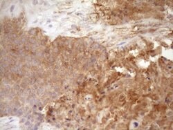 FSCN1 Monoclonal Antibody (OTI3B4), TrueMAB , OriGene 100 μL; Unconjugated:Antibodies,
