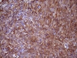 FSCN1 Monoclonal Antibody (OTI3B4), TrueMAB , OriGene 100 μL; Unconjugated:Antibodies,
